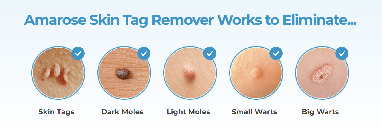 Perfect 10 Skin Tag Remover