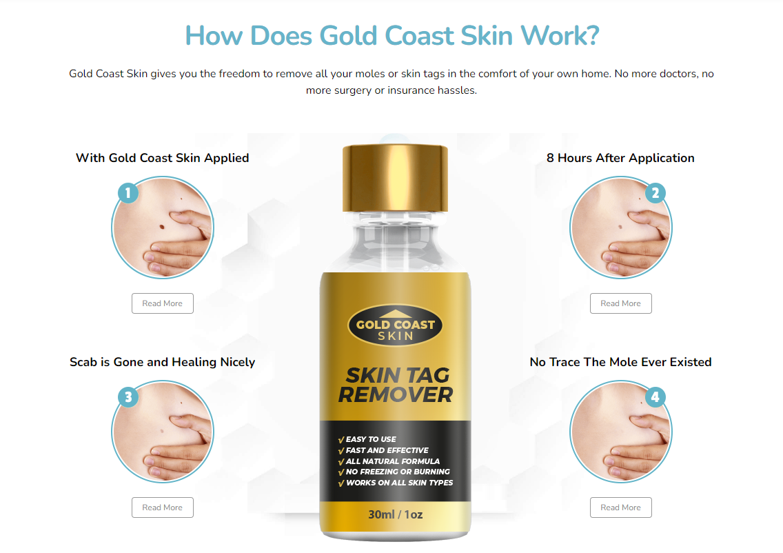 Gold Coast Skin Tag Remover Work
