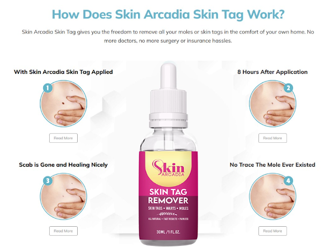 Arcadia Skin Tag Remover