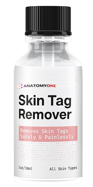 Anatomyone Skin Tag Remover (MythBusters) Consider Before Buying!